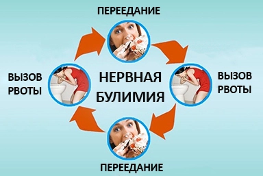 Лечение булимии в Урюпинске